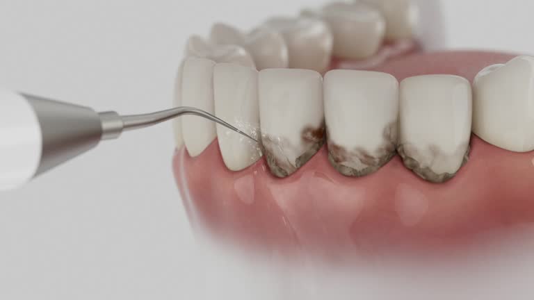 Trusted Emergency Dentist service in Ferndale, MI - Dentist Open Now